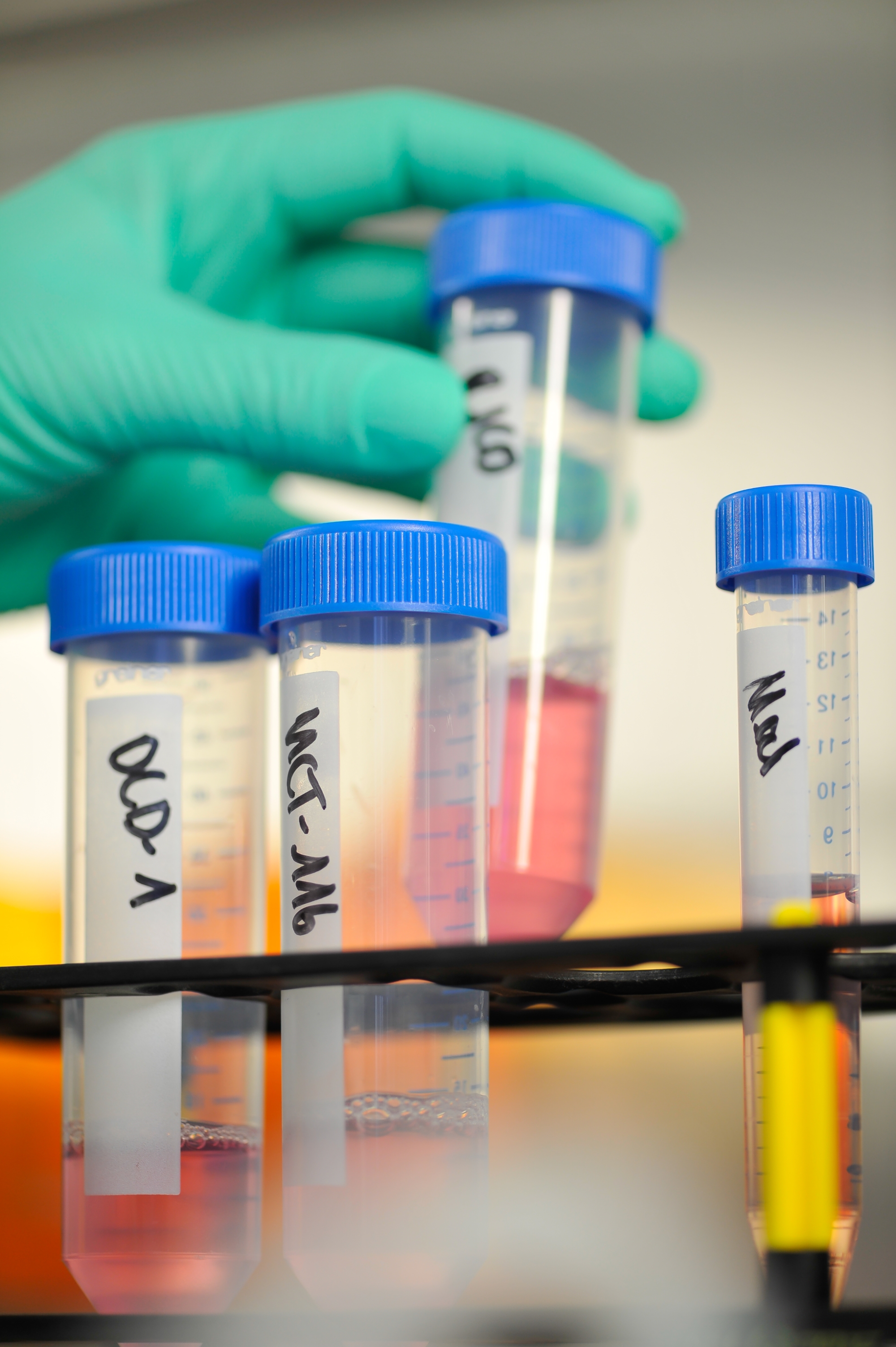 Small containers with cancer cells in nutrient solution