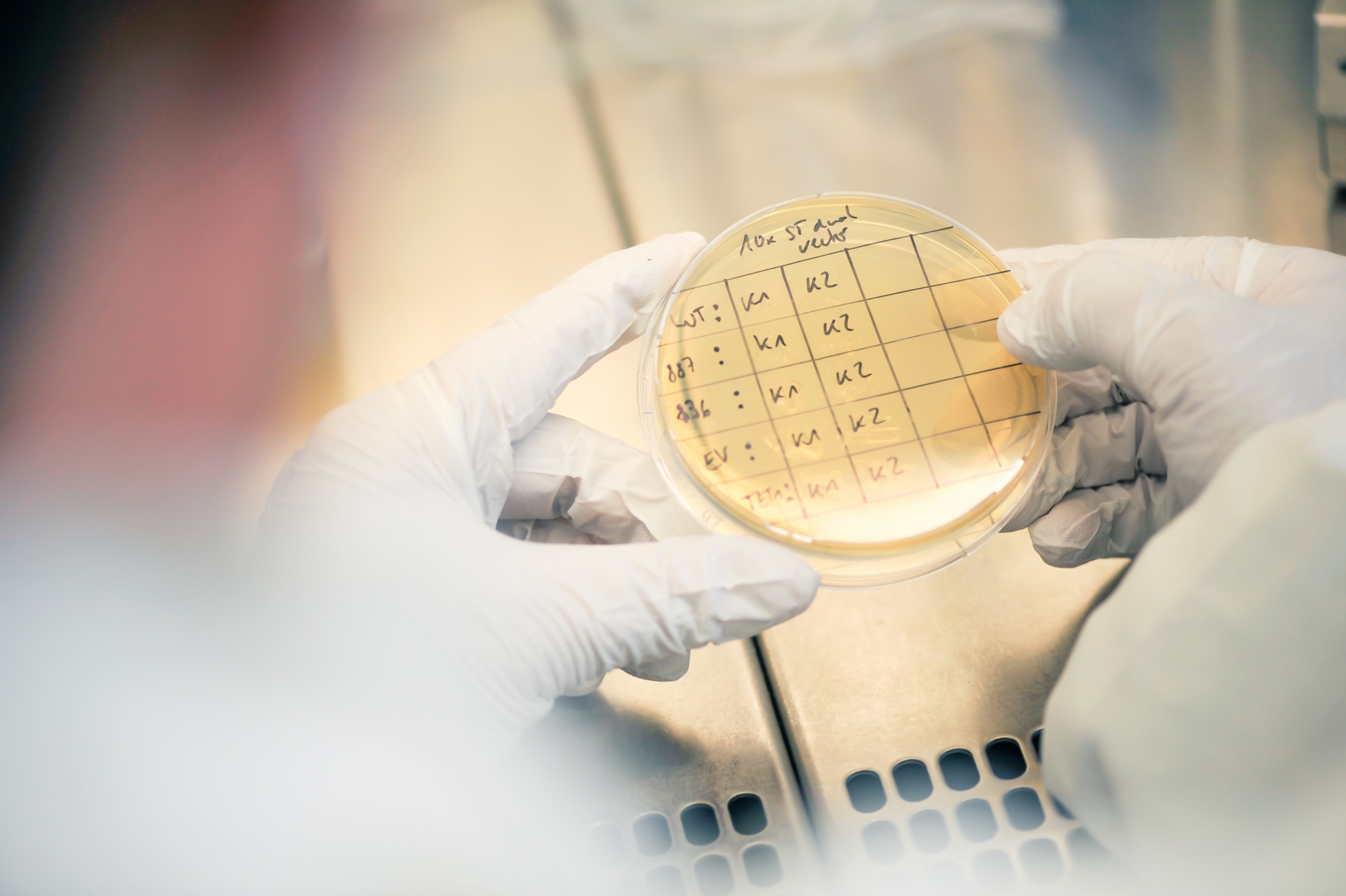 Picture of an agar plate 