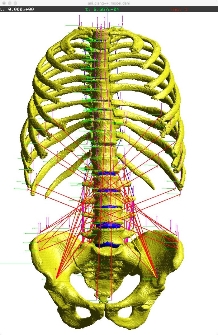 The SimTech cluster of excellence developed a spinal model. 