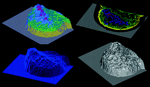 3-D-Darstellung des Drüsengewebeanteils