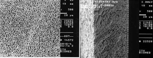 REM-Aufnahmen der Membran, Oberfläche (links) und Querschnitt (rechts).