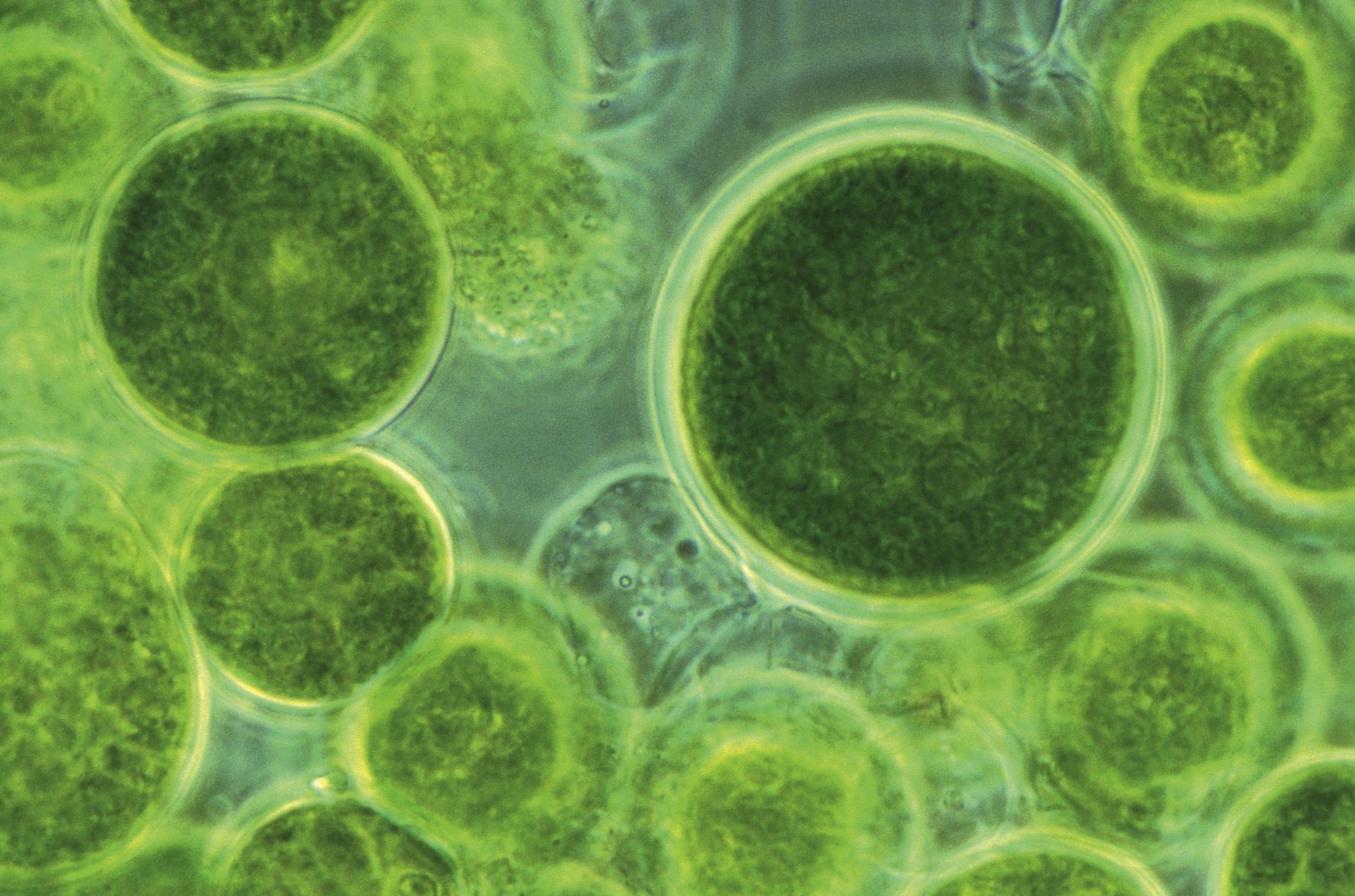 Mikroalge Haematococcus pluvialis unter dem Mikroskop