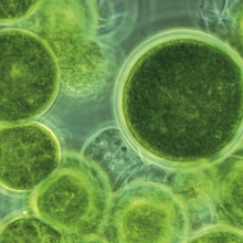 Mikroalge Haematococcus pluvialis unter dem Mikroskop