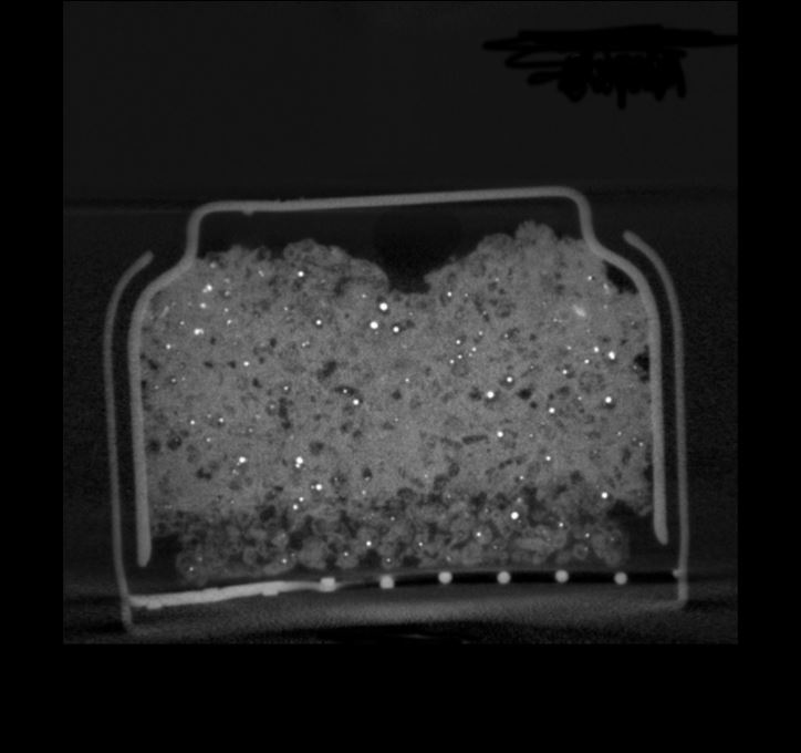 4D In-situ/Operando X-ray Tomography of a commercial Zn-Air Battery shows the dissolution of the zinc particles during disscharge.